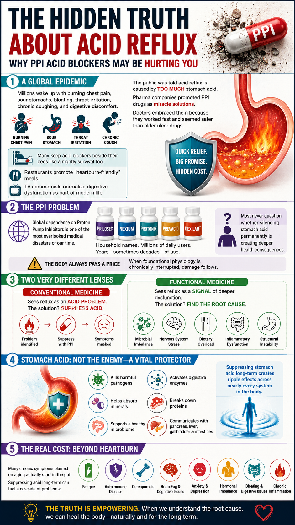 The truth about acid reflux and PPIs