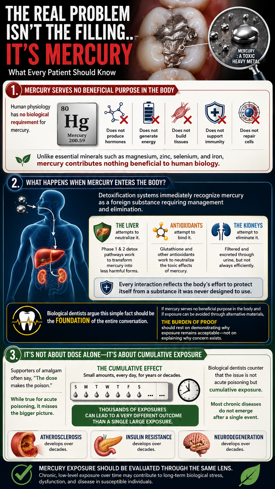 Mercury in dental fillings infographic