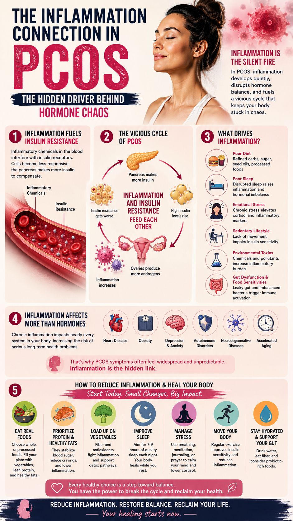 The inflammation connection in PCOS
