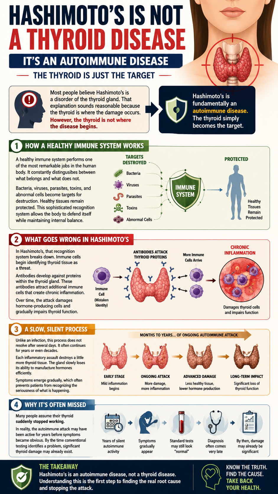 Understanding Hashimoto's Disease An Autoimmune Focus