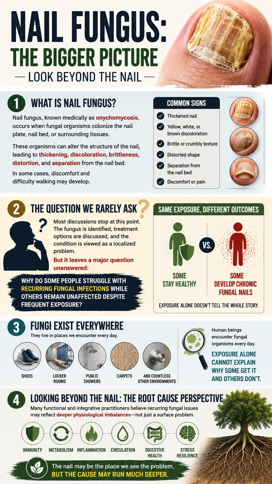 Understanding nail fungus and its causes