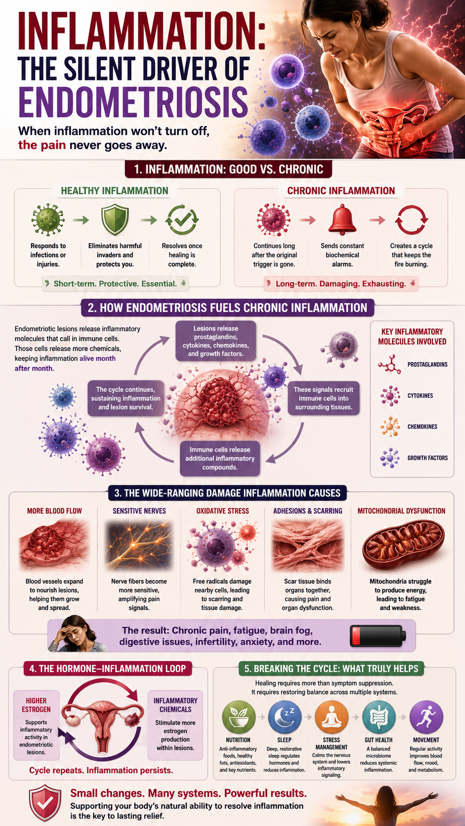 Inflammation and Endometriosis Infographic