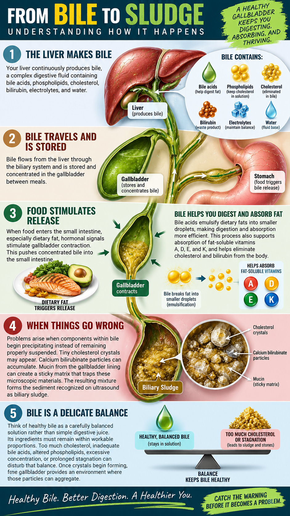 From Bile to Sludge Gallbladder Balance