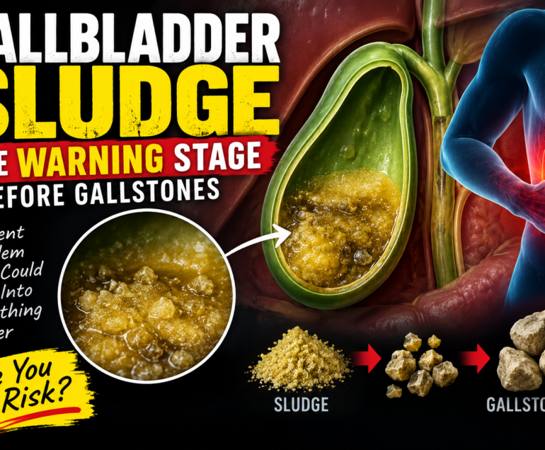 Gallbladder Sludge The Warning Stage